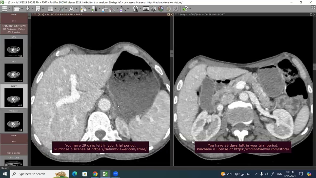 Session 107, Radiology Interactive Course, Dr  Ibrahim Shalaby
