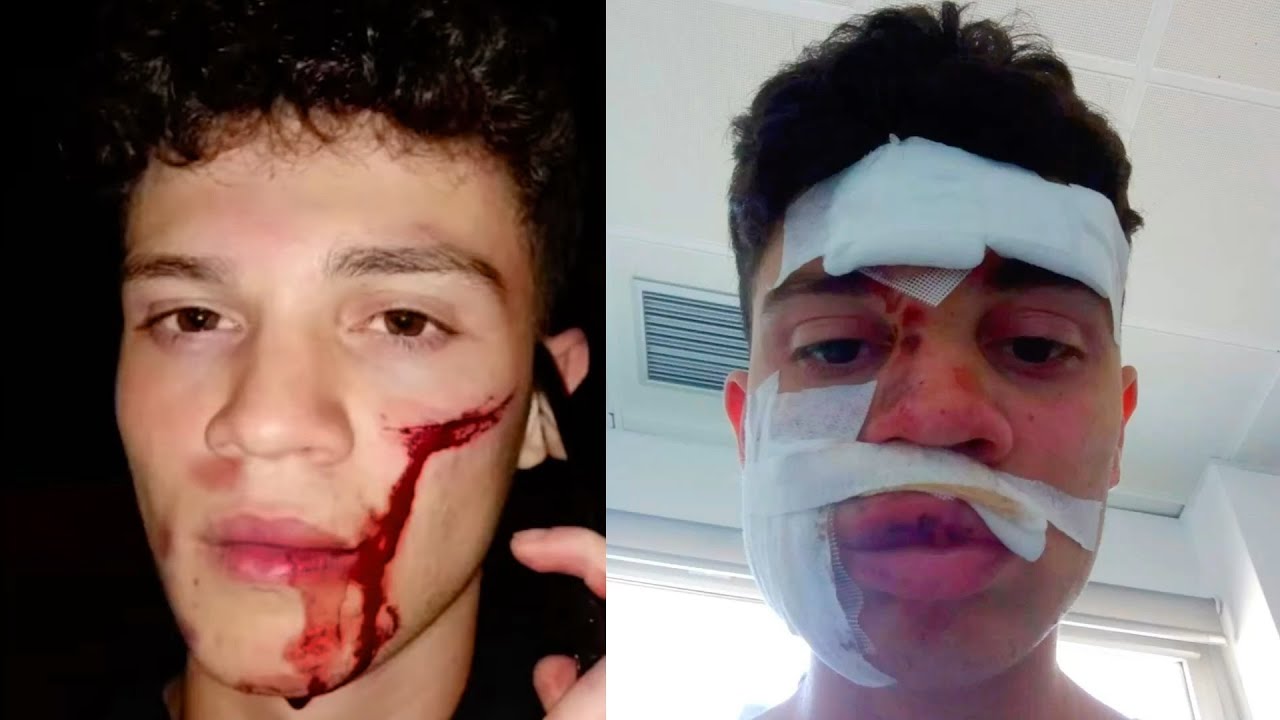 La P*TA REALIDAD de las PELEAS CALLEJERAS.