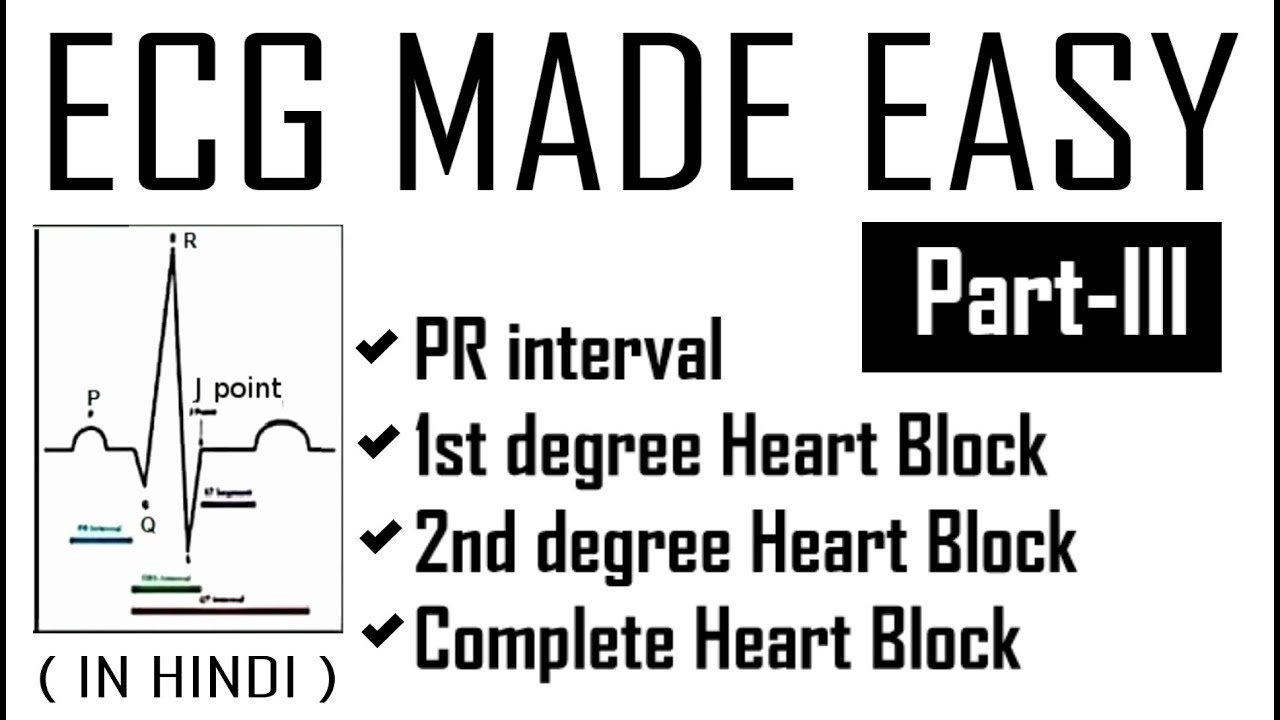ECG MADE EASY - Part 3 | PR Interval , 1st 2nd & 3rd degree/ Complete Heart Blocks | Dr.EDUCATION