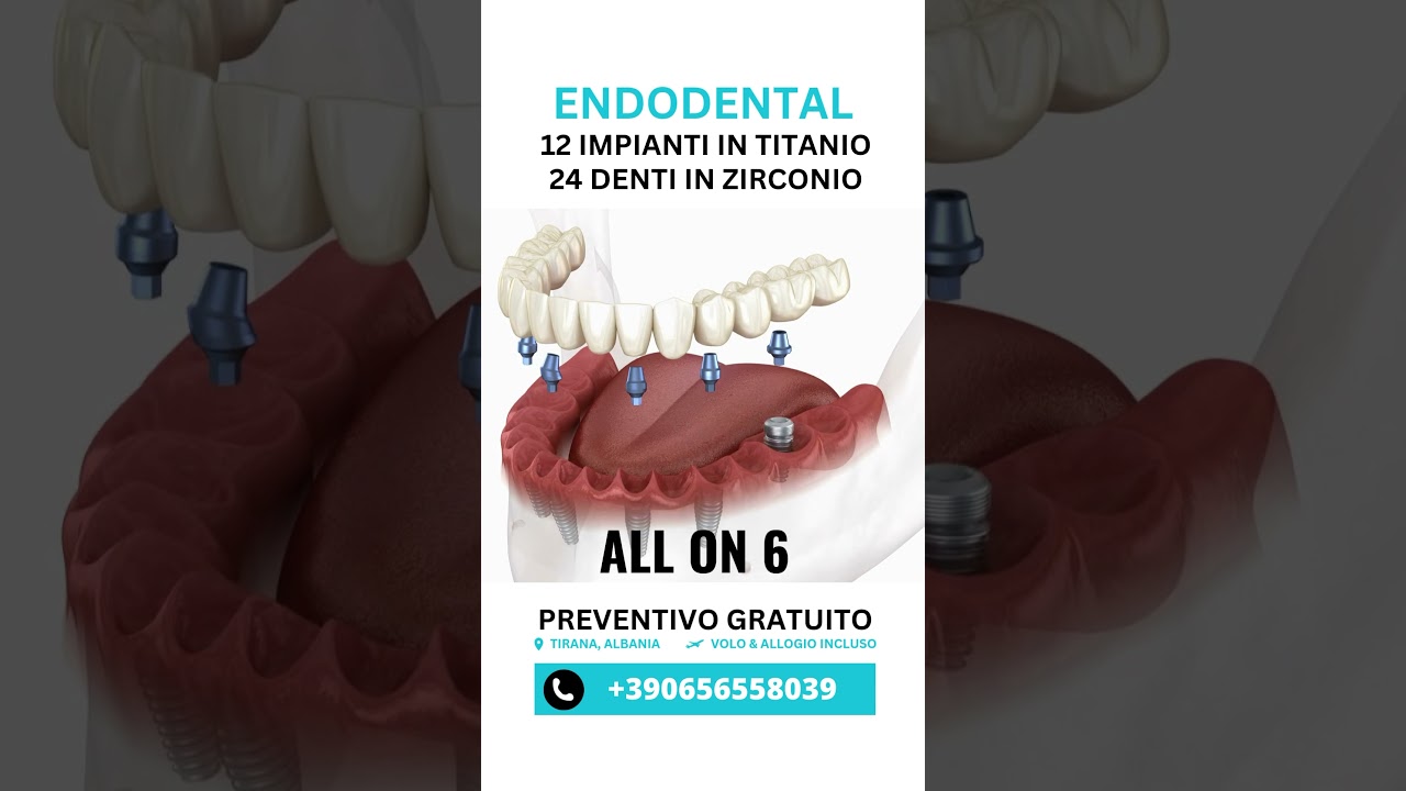 12 IMPIANTI in TITANIO+24 Denti In ZIRCONIO
