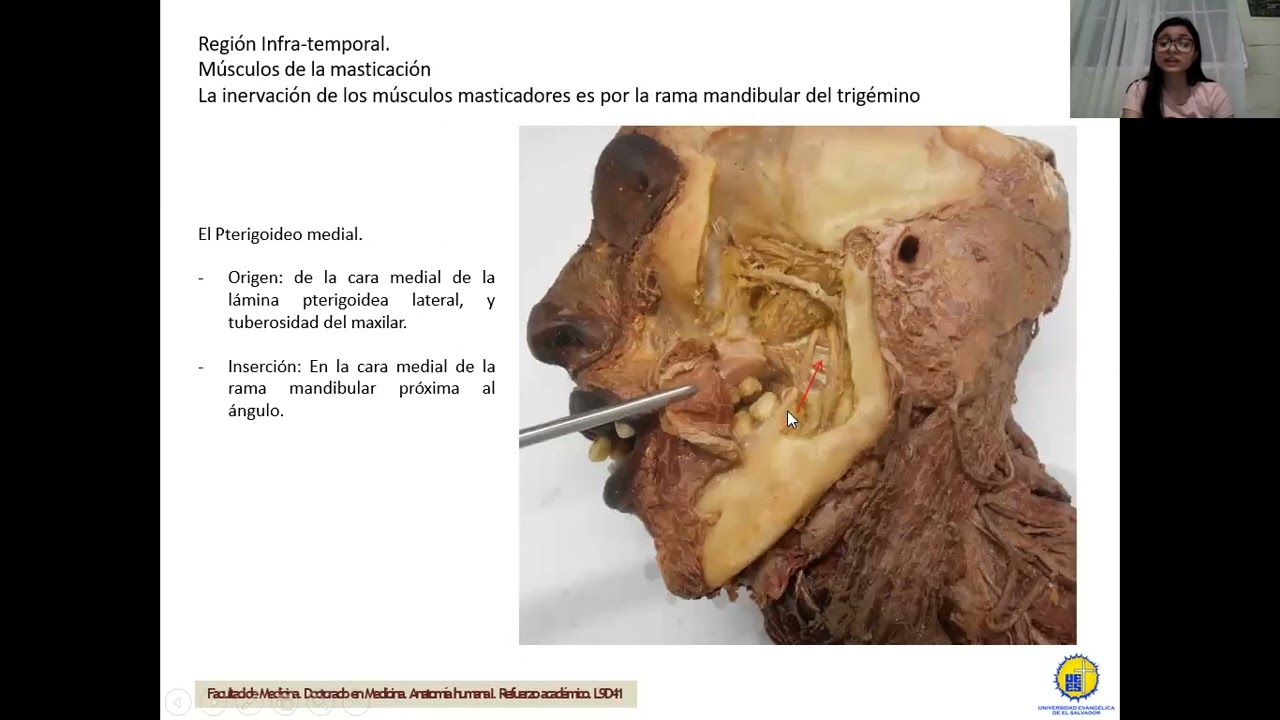 Lab: Fosa Temporal, Infratemporal, Pterigopalatina. Region Parotida y musculos Faciales