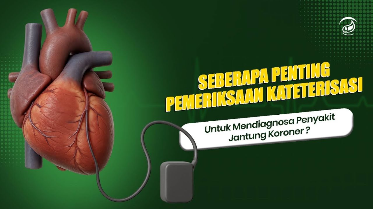 Kateterisasi Jantung? 🚫 Belum Tentu Perlu! Ini Fakta yang Banyak Orang Tidak Tahu