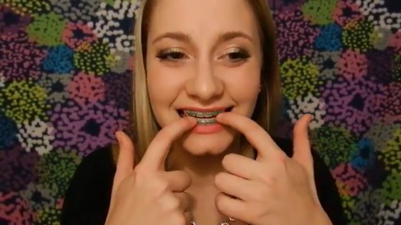 Rubber bands for braces tutorial