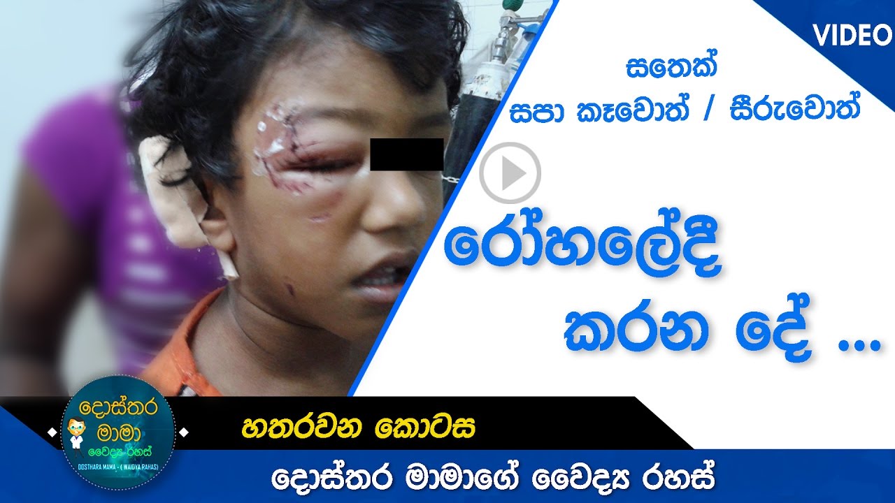 Rabies (Part 4) - සතෙකු සපා කෑවොත් /  සීරුවොත් - රෝහලේදී කරන ප්‍රතිකාර - (හතරවන කොටස)