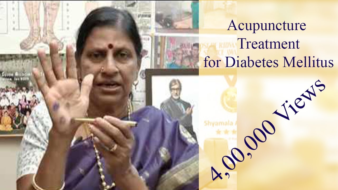 Acupuncture Treatment for Diabetes Mellitus Natural Medicine இயற்கை மருத்துவம்-#Dr.ShyamalaOfficial