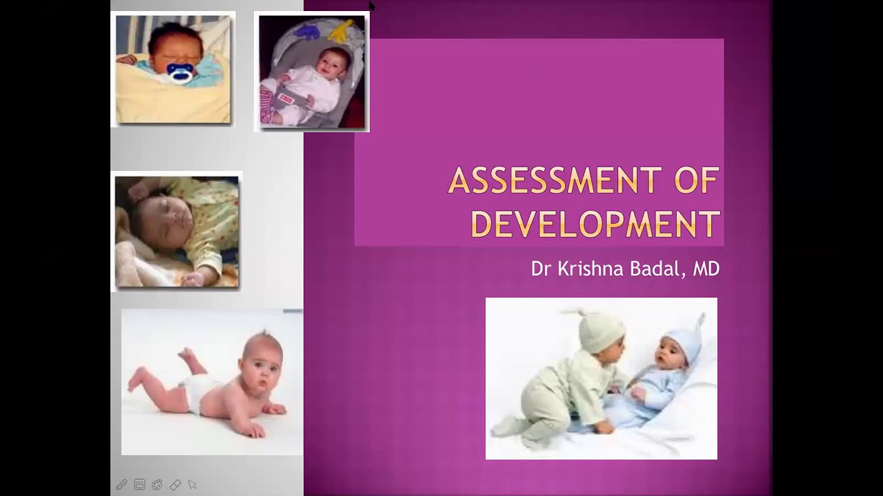 Assessment of development in a child
