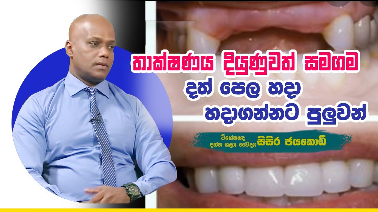 තාක්ෂණය දියුණුවත් සමගම දත් පෙල හදාගන්නට පුලුවන් | Piyum Vila | 28 -08-2019 | Siyatha TV