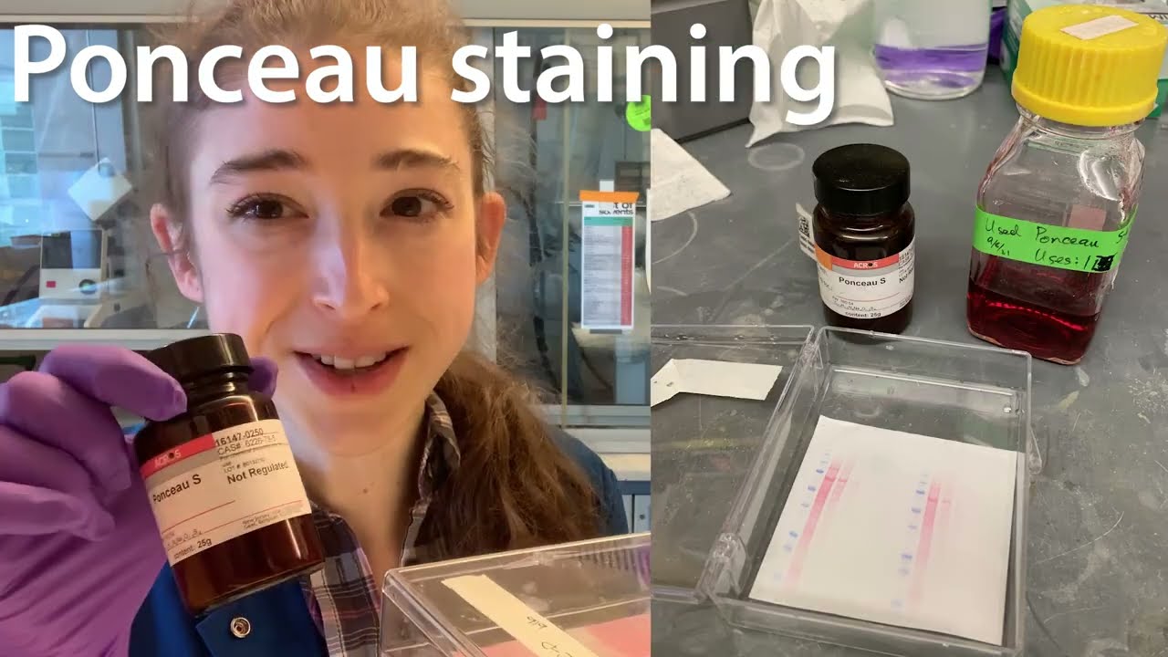 Ponceau staining - what, why, & how with some practical tips