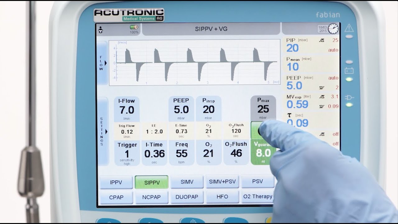 fabian HFO: SIMV Synchronized Intermittend Positive Pressure Ventilation
