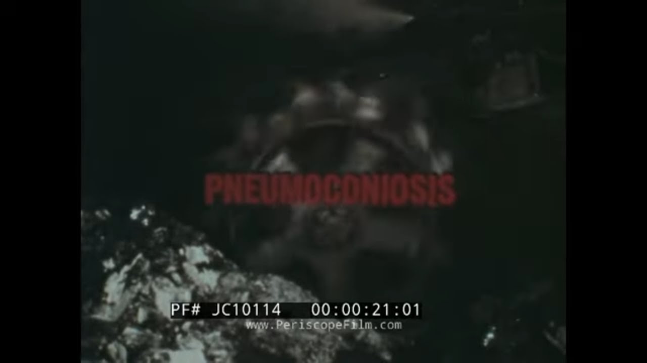 &ldquo; PREVENTING COAL PNEUMOCONIOSIS 