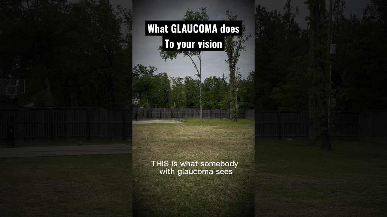 This is what glaucoma does to your vision