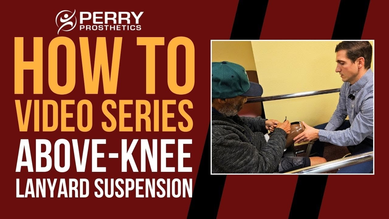 Above Knee Prosthetic Lanyard Suspension: How-To Series
