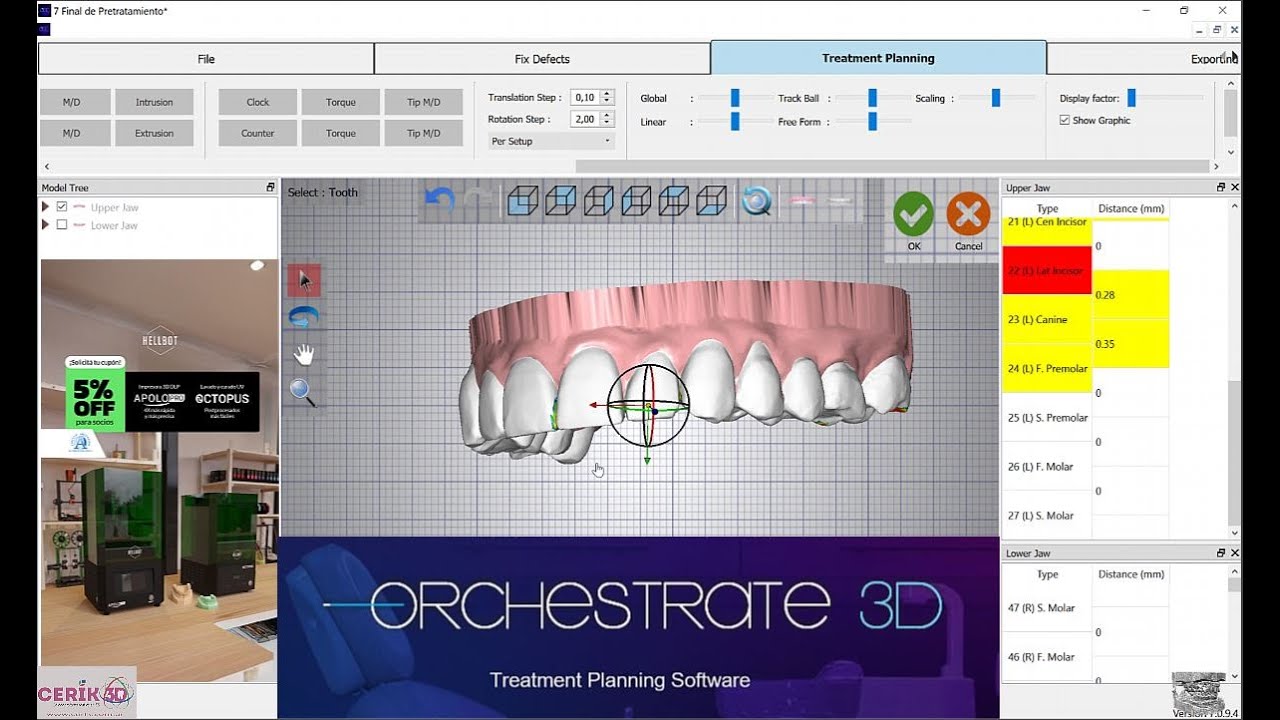 CERIK3D - video 6 - Orchestrate3D V7-  Tratamiento completo en Alineadores O3D v7- Pretrat y Trat.