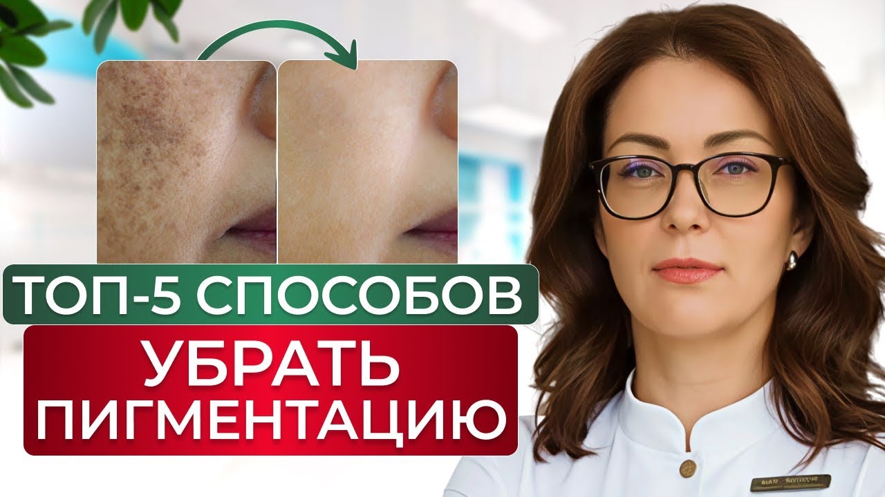 Как ИЗБАВИТЬСЯ от ПИГМЕНТНЫХ ПЯТЕН НАВСЕГДА? Секреты от косметолога!