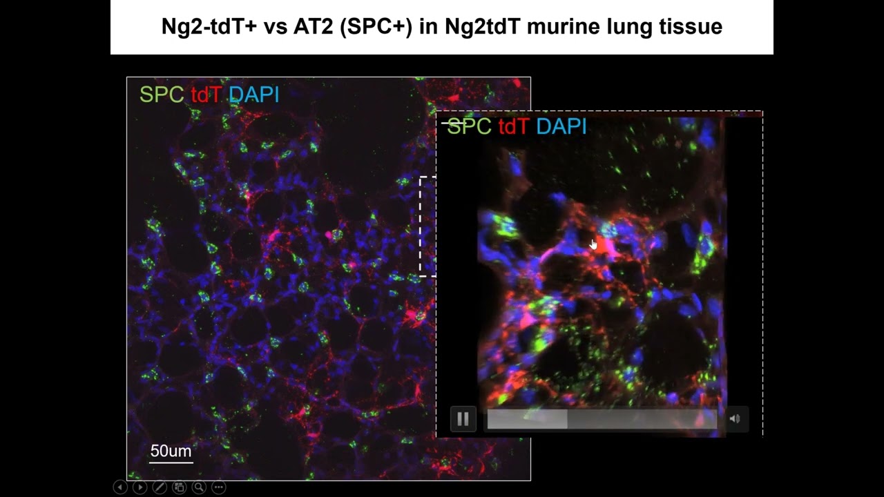 Mural Cell SDF1 Signaling Is Associated with The Pathogenesis of Pulmonary Arterial Hypertension