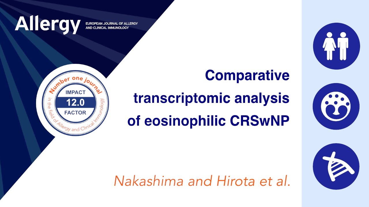 Comparative Transcriptomic Analysis of Eosinophilic CRSwNP Using Nasal Tissue and Brushing Samples