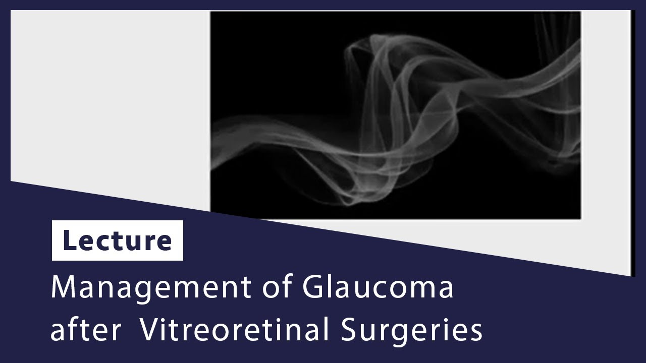Management of Glaucoma after  Vitreoretinal Surgeries