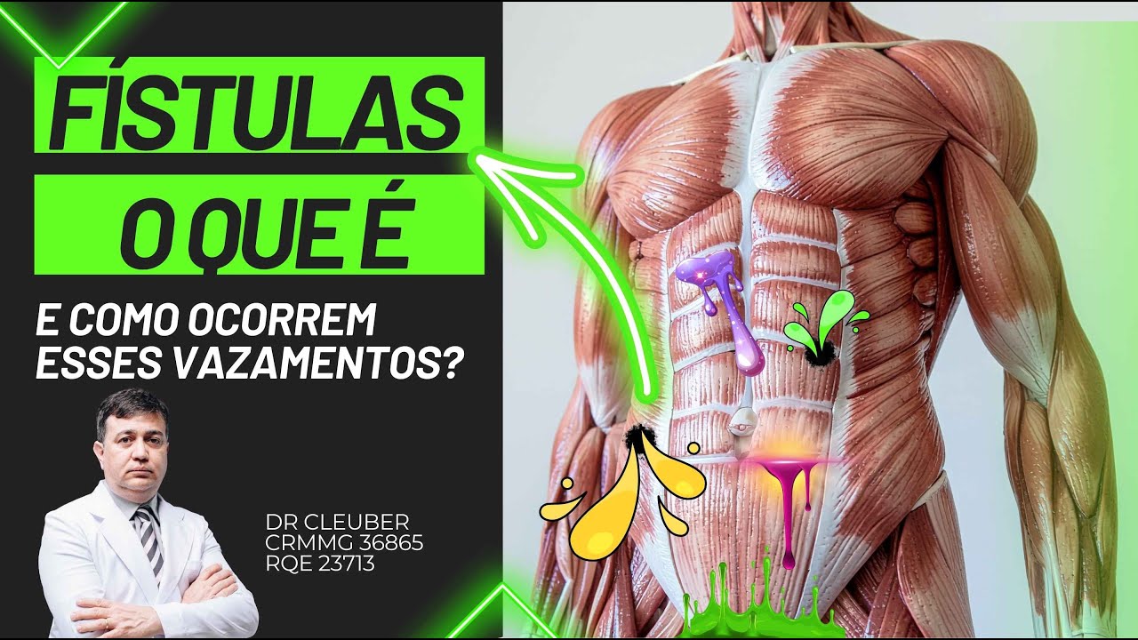 Fístula: o que é, por que acontece e quando precisa de tratamento
