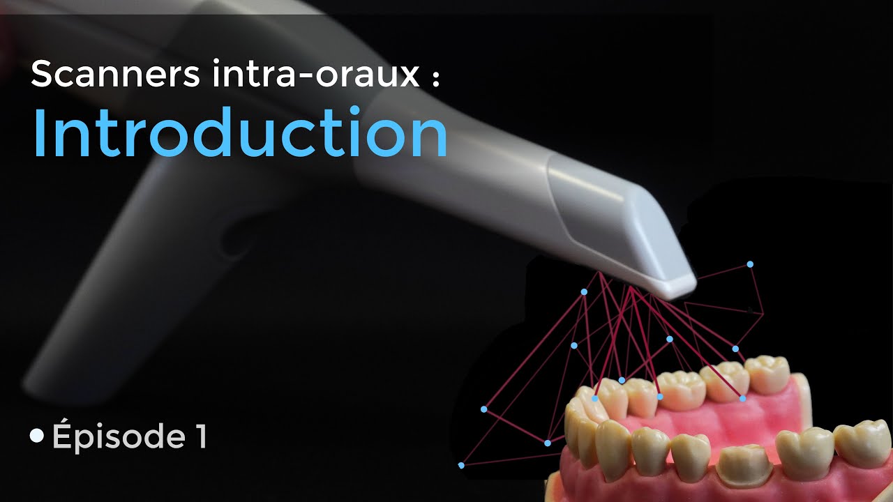 Scanner intraoral (Trios) - Introduction