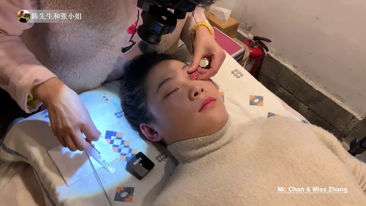 头发丝通泪腺 张小姐最爽的一次洗眼 - #ASMR #洗眼 #eye cleaning
