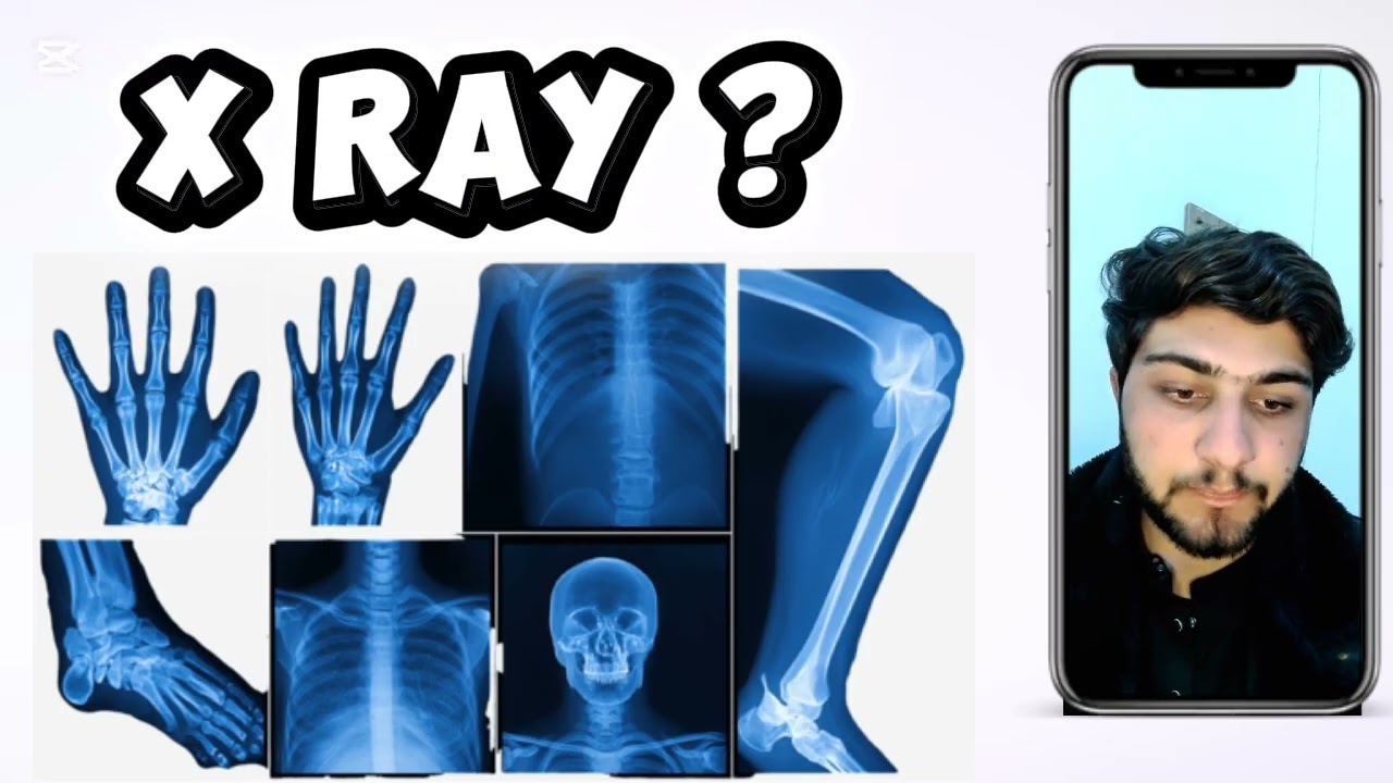 Episode 5 “X-Ray Explained in Simple Urdu”2️⃣ “What is X-Ray?