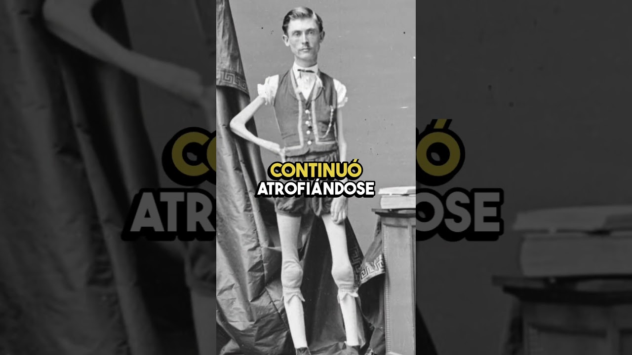 La persona m&aacute;s delgada de la historia pesaba 21 kg 🤔🎪 #shorts