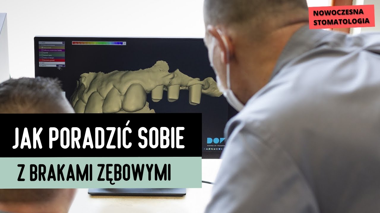 UZUPEŁNIANIE BRAKÓW ZĘBOWYCH l DENTAL CORNER WROCŁAW