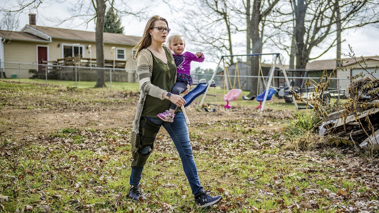 The new C-Brace®: Users tell their stories