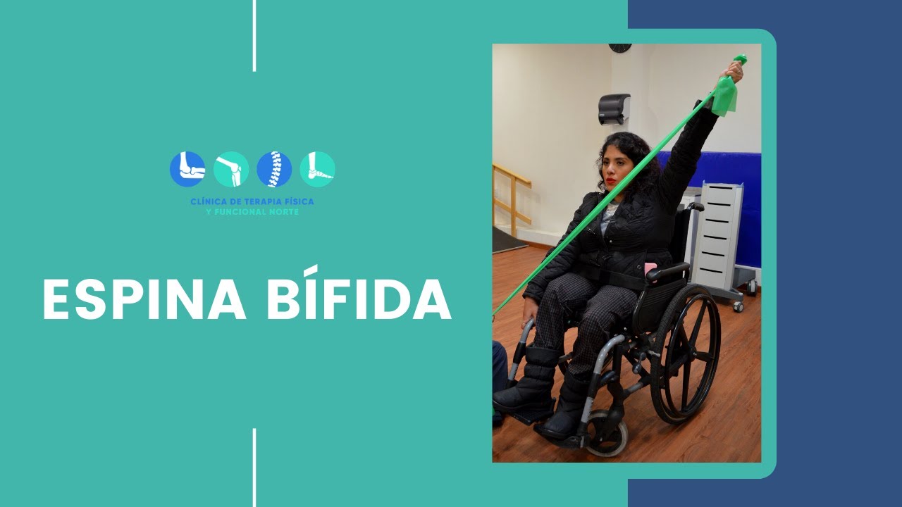 Espina bífida: Mitos y verdades