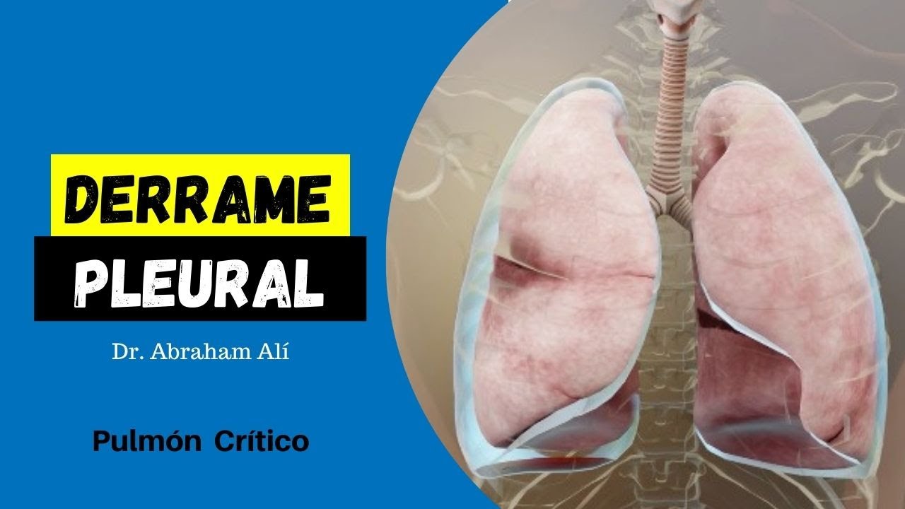 Derrame Pleural (Definición y Estudio) Primera Parte