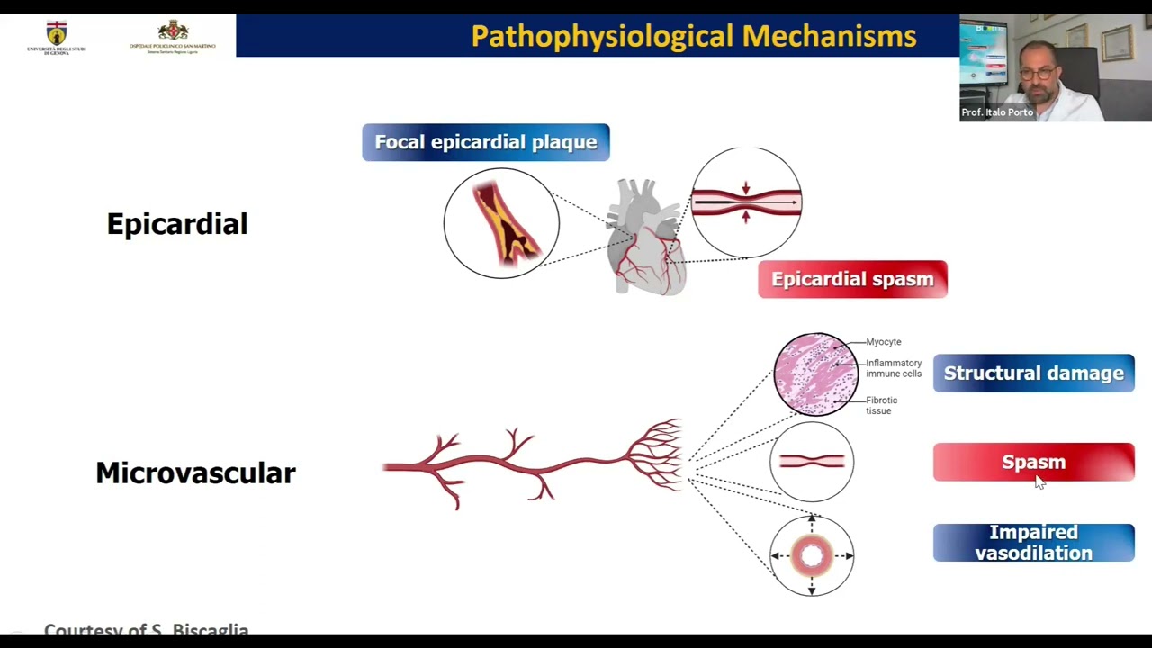 ASPETTI FISIOPATOLOGICI DEL MICROCIRCOLO: UN MECCANISMO CRUCIALE NELLA CARDIOPATIA ISCHEMICA