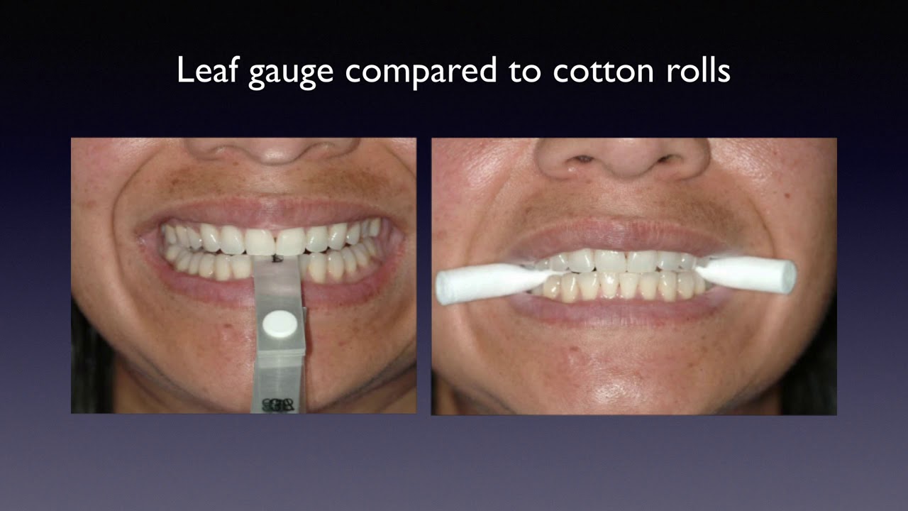 Part Three - Centric Relation  & Equilibration