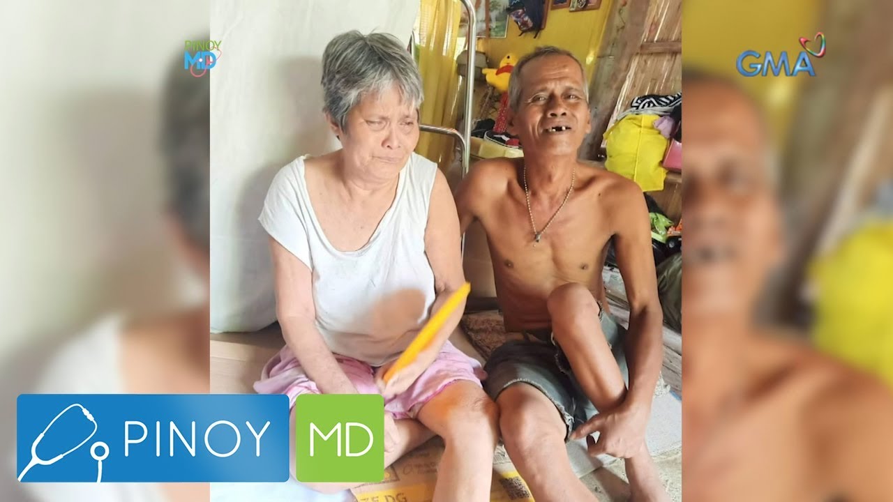 Pinoy MD: Polio virus, paano ba maiiwasan?
