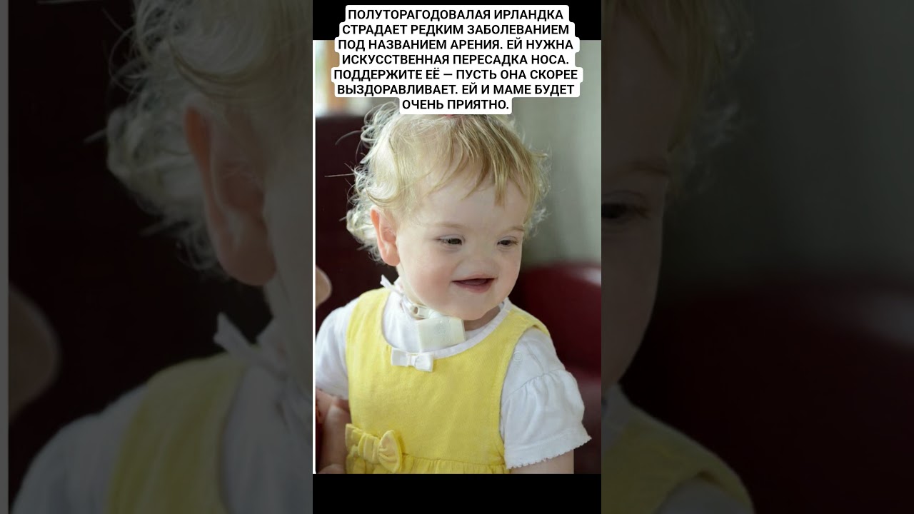 ПОЛУТОРАГОДОВАЛАЯ ИРЛАНДКА СТРАДАЕТ РЕДКИМ ЗАБОЛЕВАНИЕМ ПОД НАЗВАНИЕМ АРЕНИЯ. ЕЙ НУЖНА ИСКУССТВЕННАЯ