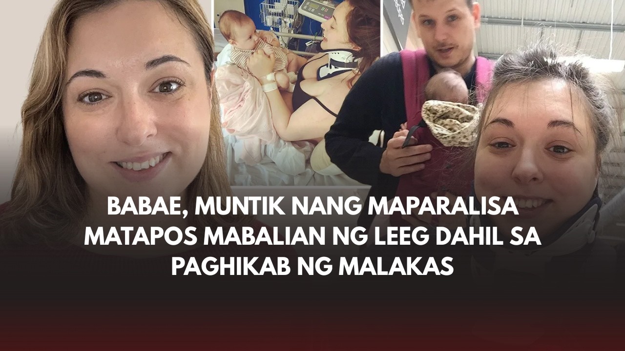 Babae, muntik nang maparalisa matapos mabalian ng leeg dahil sa paghikab ng malakas