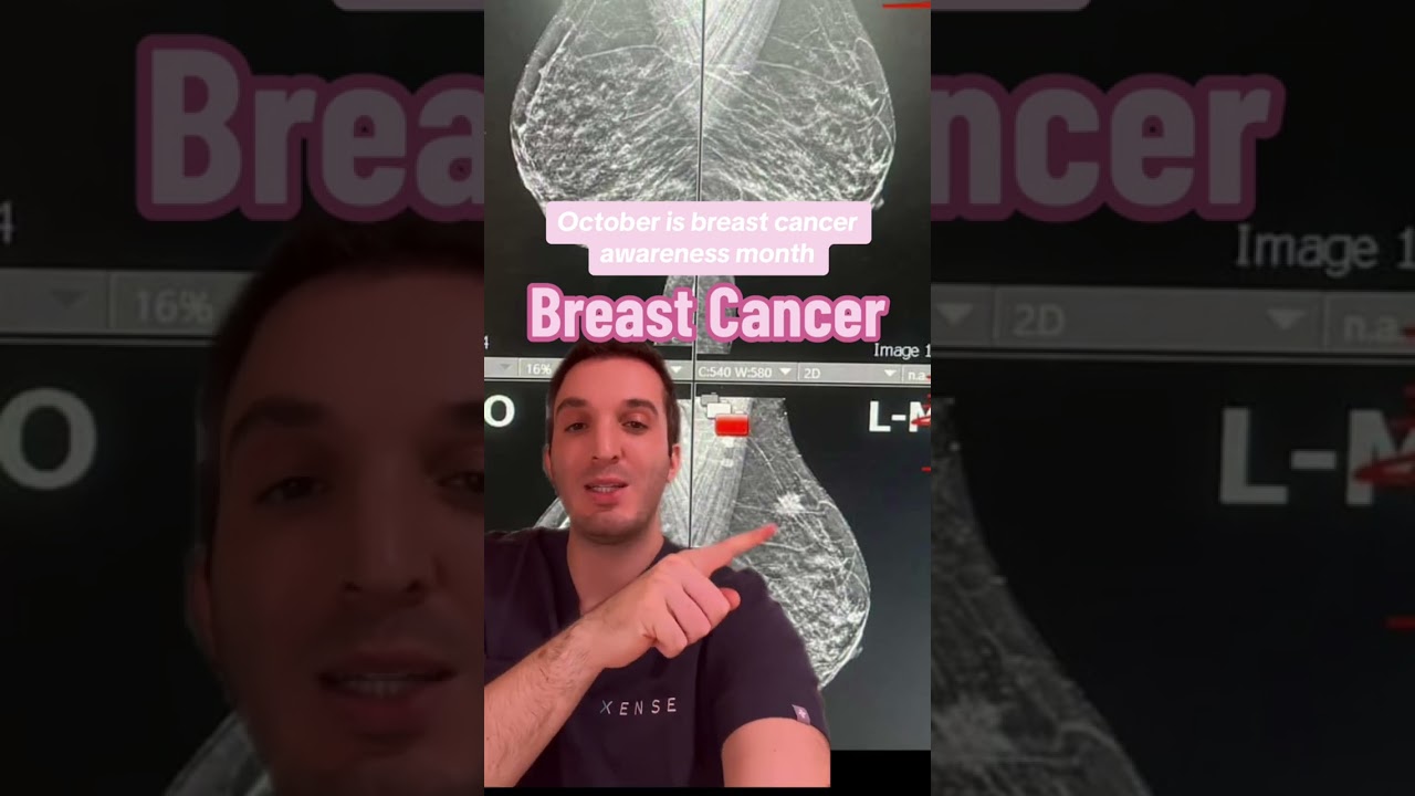 Breast cancer diagnosed on mammogram