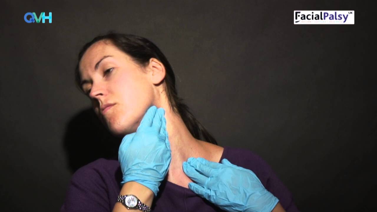 Facial Palsy DVD 2 - Management of Synkinesis - Stretches for the Tight Side