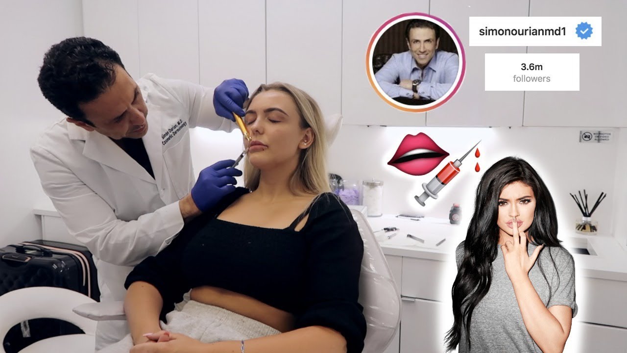 I Got Lip Filler Done By Kylie Jenners ACTUAL Surgeon...