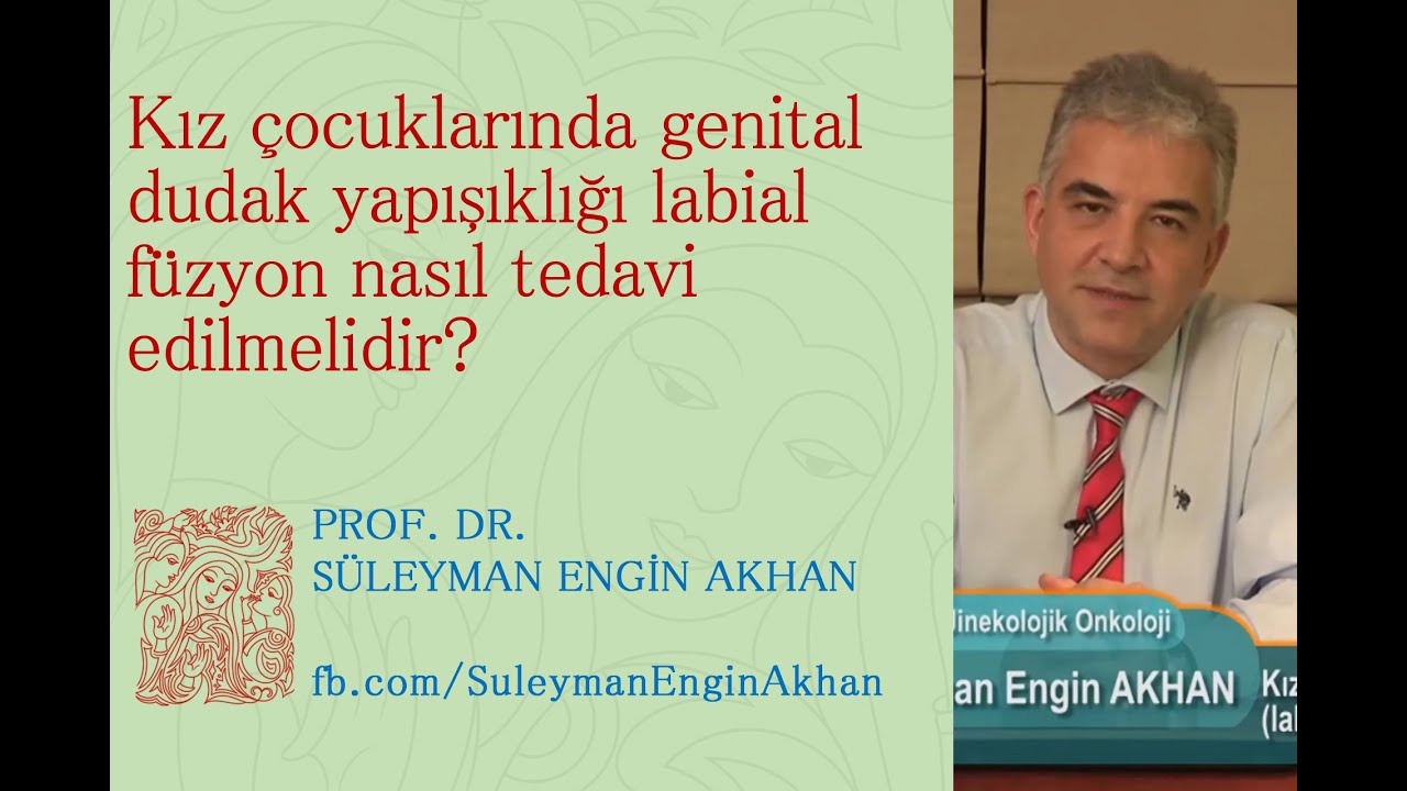 Kız çocuklarında genital dudak yapışıklığı labial füzyon nasıl tedavi edilmelidir? Süleyman Akhan