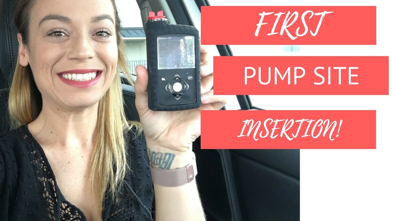 Vlog: My FIRST Medtronic Site Insertion!