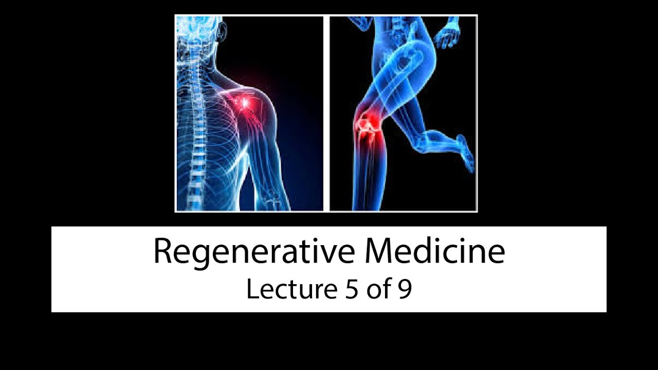 Regenerative Joint Therapy: Exosomes Lecture 5 of 9