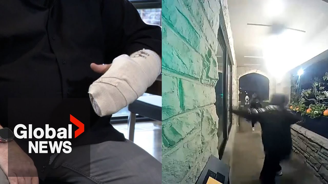 Couple speaks out after husband injured in violent Toronto home invasion