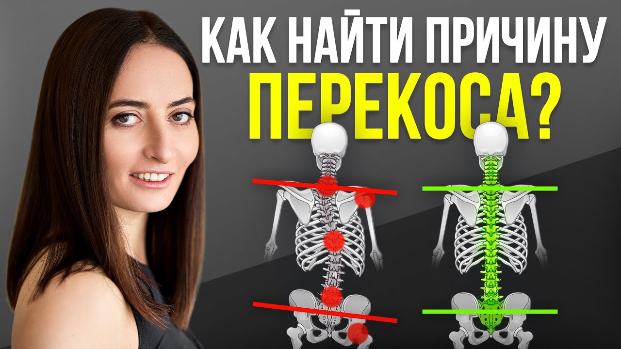 Одно плечо выше другого, перекос таза, сколиоз, искривление позвоночника? Пройди 4 ТЕСТА