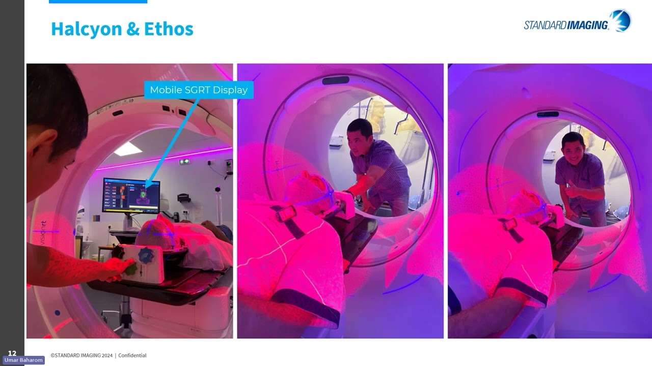 3DoF Precision for Intracranial SRS – Introducing the TruPose™ Head Adjuster