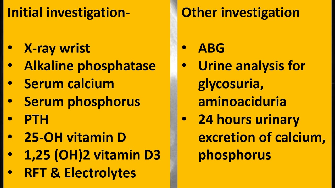 Approach to a case of rickets (Part 3/3) | Rickets | Pediatrics