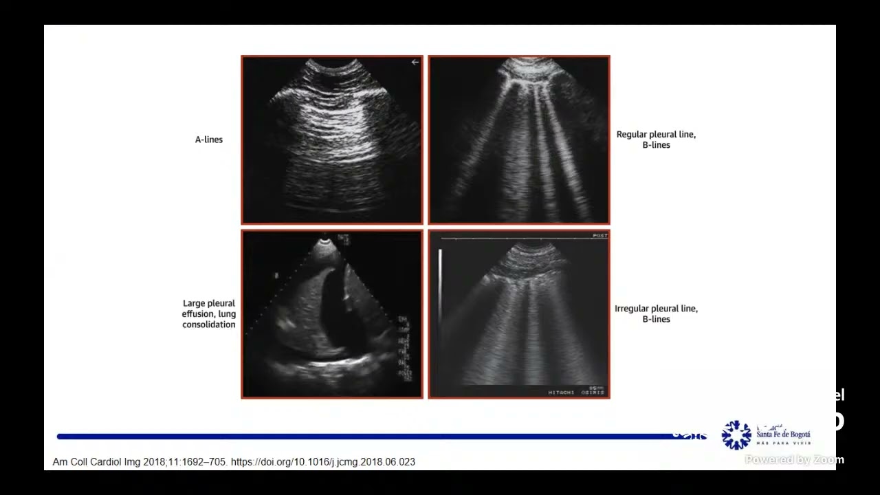 Ultrasonido en la UCI cardiovascular