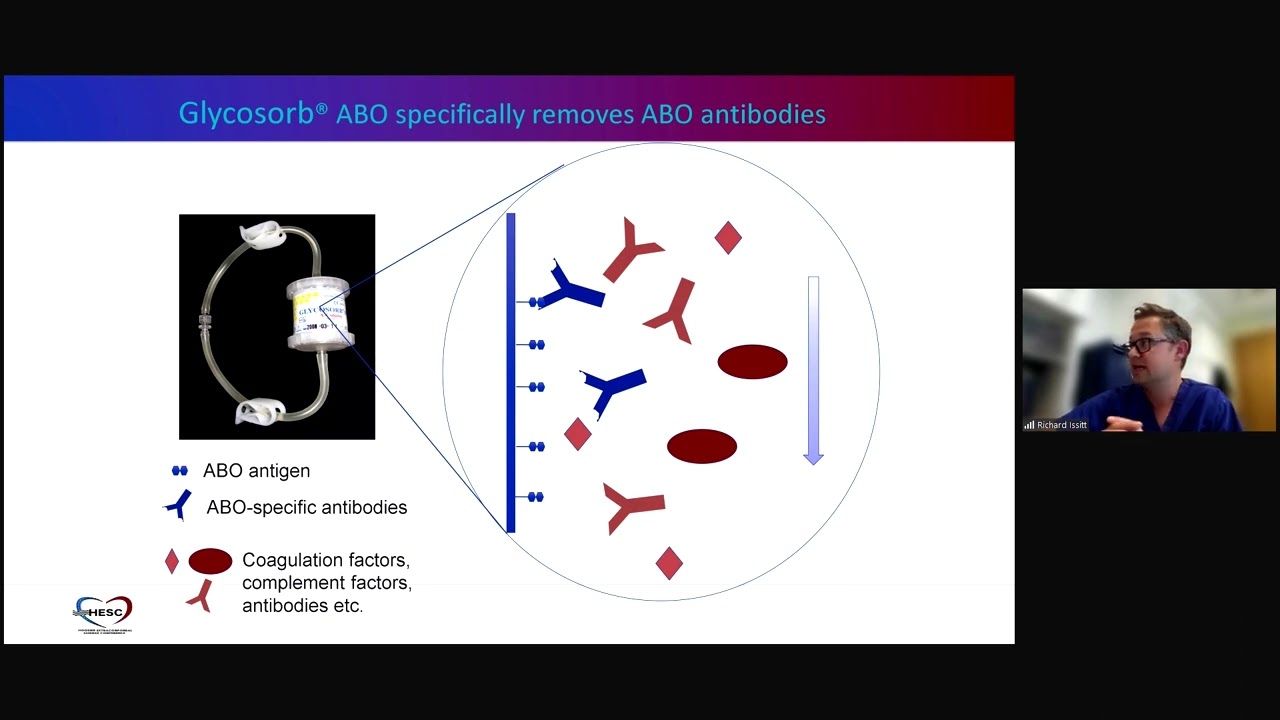 (ABO-Incompatible Transplant Therapy) HESC-2022 in Indianapolis, IN