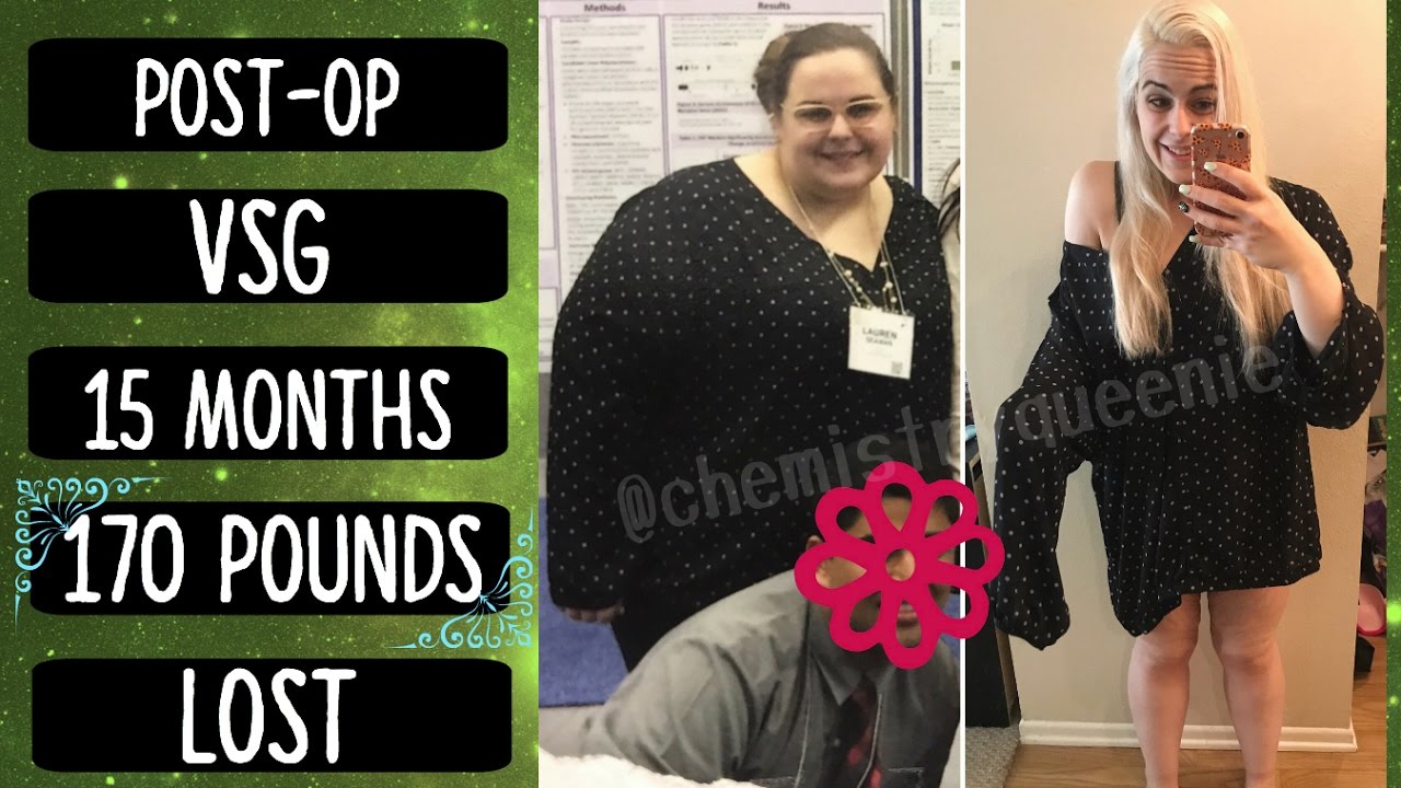 15 MONTHS Post-Op VSG || 170 POUNDS LOST! || Full Body Pictures!
