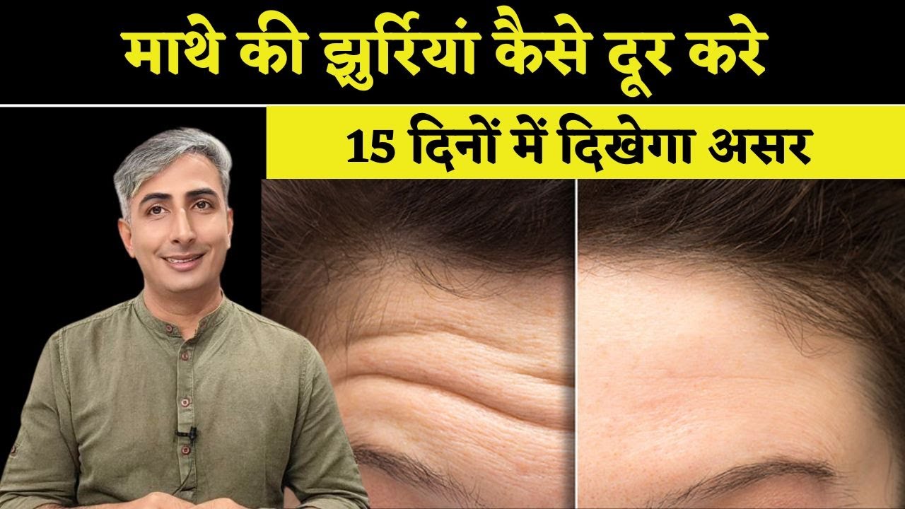 Forehead Wrinkles से हमेशा के लिए छुटकारा । माथे की झुर्रियां कैसे दूर करे l DR. MANOJ DAS