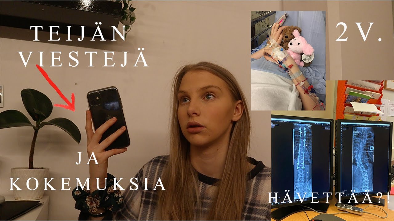 SKOLIOOSI LEIKKAUKSEN JÄLKEEN l kokemuksia💕
